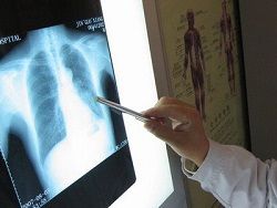 
11% рост числа онкологических заболеваний в Саудовской Аравии